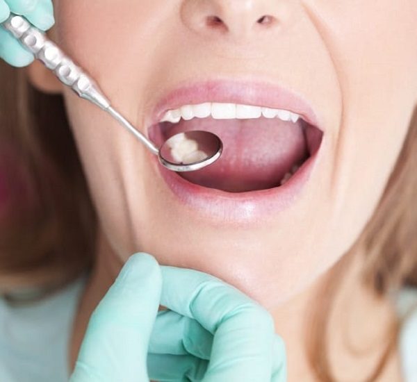 Female patient with open mouth  receiving dental inspection at dentist's office